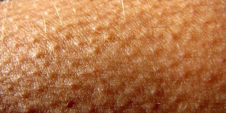 سبب القشعريرة المفاجئة في علم النفس