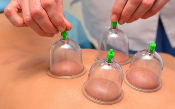 ما هو لون دم الحجامة للمسحور؟